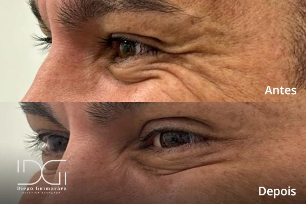 Harmonização facial masculina em Curitiba