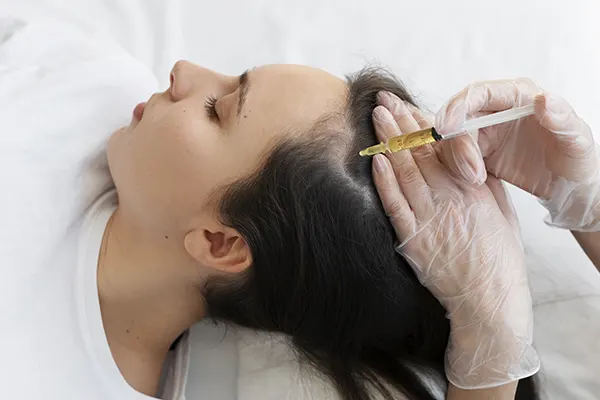 tratamento para queda de cabelo feminino em Curitiba